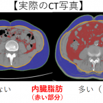 内臓脂肪